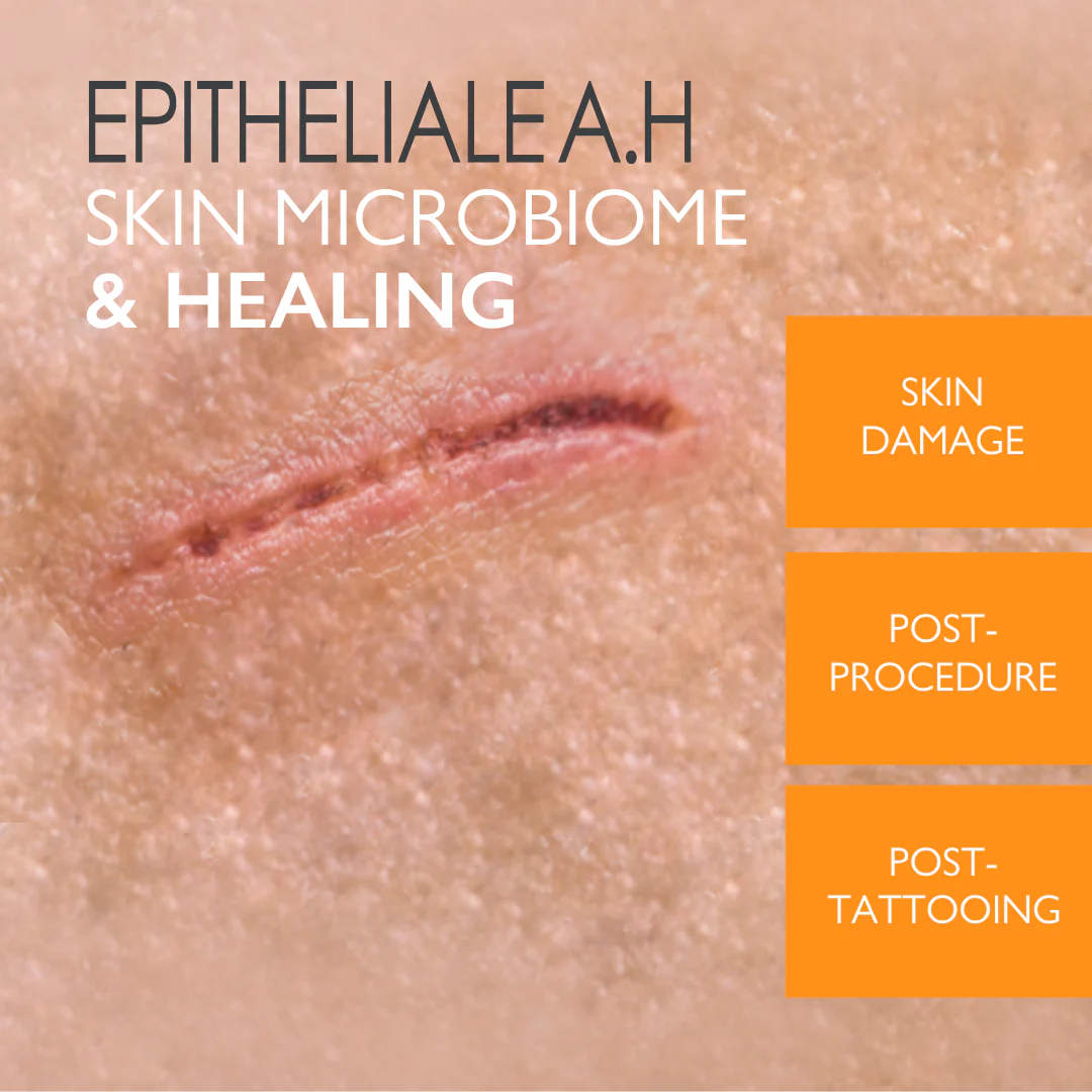 Buy One Get One A-Derma Epitheliale AH Ultra Anti-mark Ultra Repairing cream 40ml - Image 3