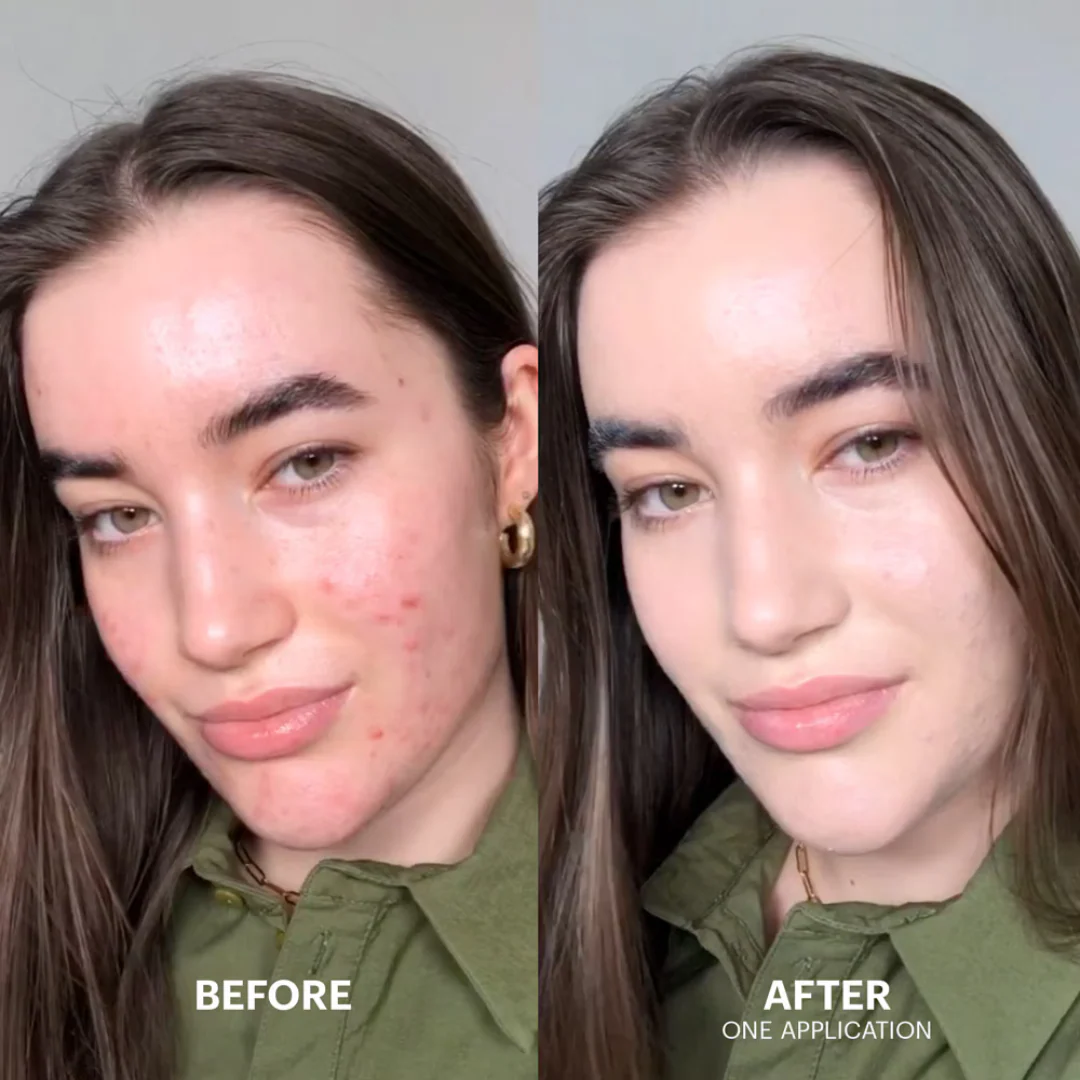 Cicapair™ Tiger Grass Color Correcting Treatment Spf 30 - Image 2