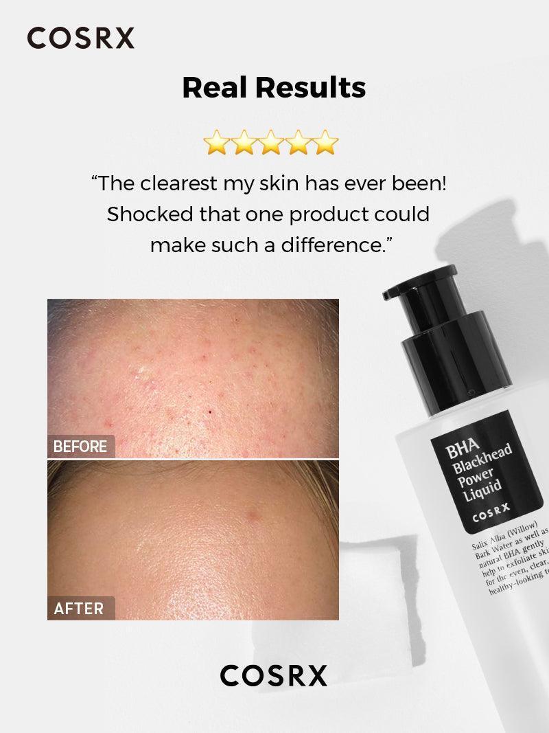 BHA Blackhead Power Liquid - Image 4