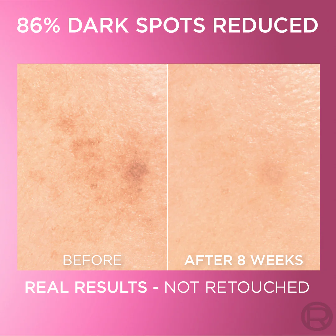 Glycolic Bright Serum with 8% [Melasyl ™ + Glycolic Acid + Niacinamide] face serum for Dark Spots & Brightening 30ml - Image 5