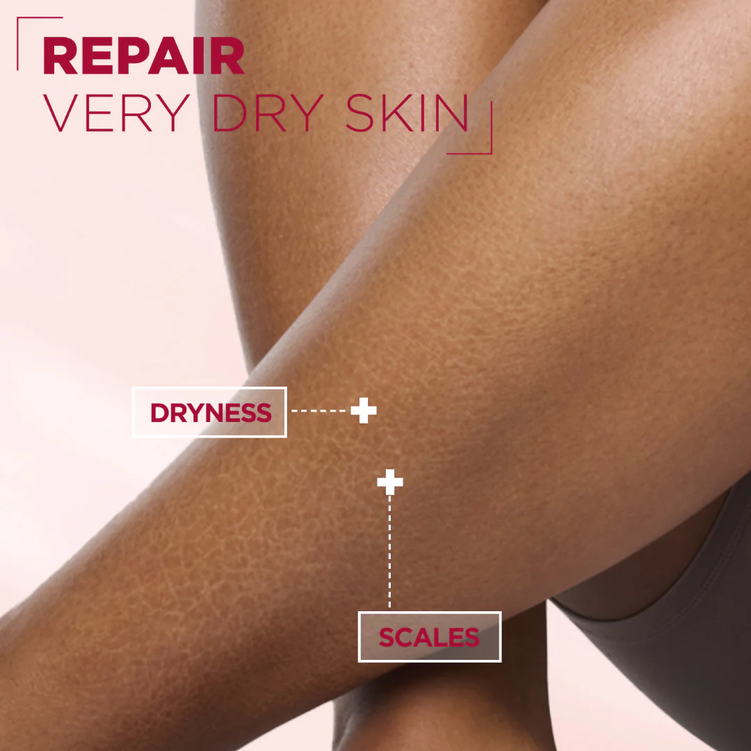Urea Cica Repair Cream Jar - For Keratosis Pilaris, Dry Rough Fragile Skin & Tiny Reddish Bumps - For Face, Hands & Body - Image 2