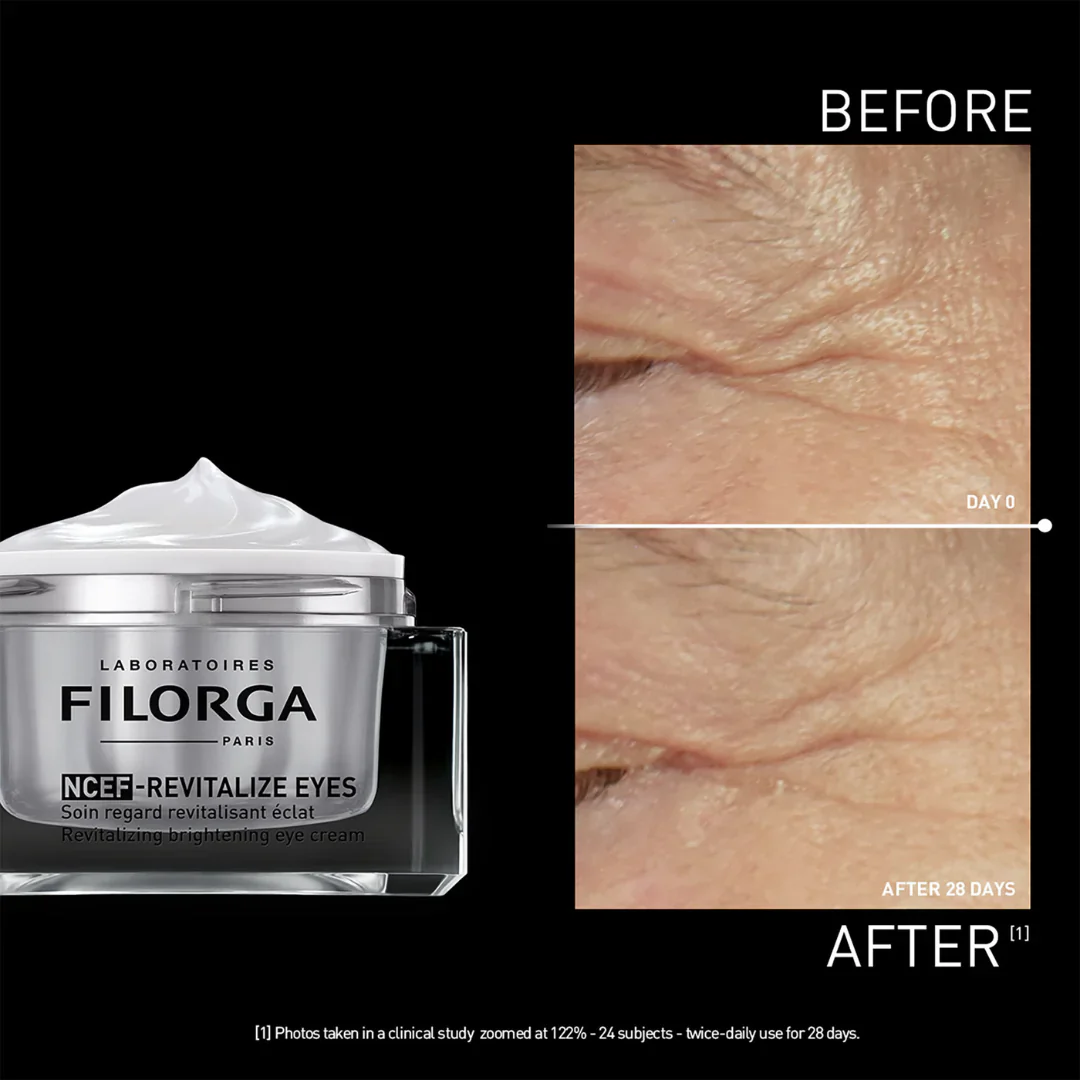 NCEF Revitalize Eyes - Image 6