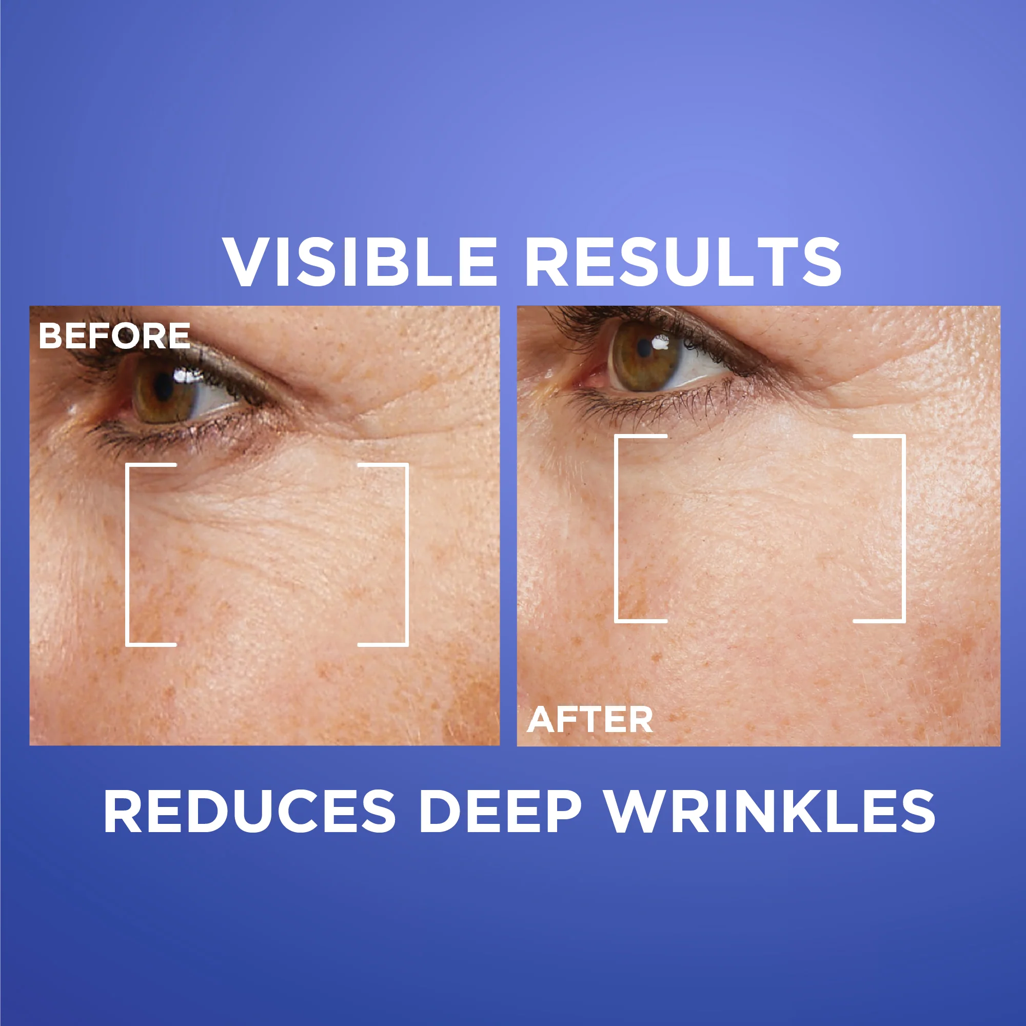 Revitalift Retinol Night Serum For Face, With 0.2% Pure Retinol, Moisturizes Skin and Eliminates Deep Wrinkles, For All Skin Types - Image 3