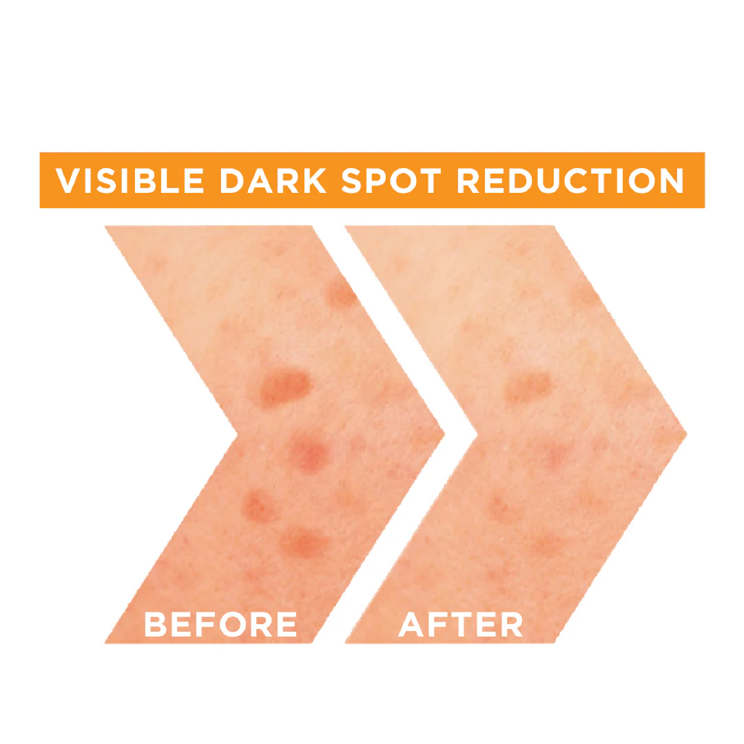 Fast Bright Vitamin C + Niacinamide 30x Brightening Booster Serum - Image 5