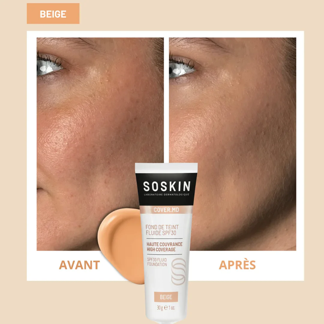 Soskin Fluid Foundation SPF30 - Image 5