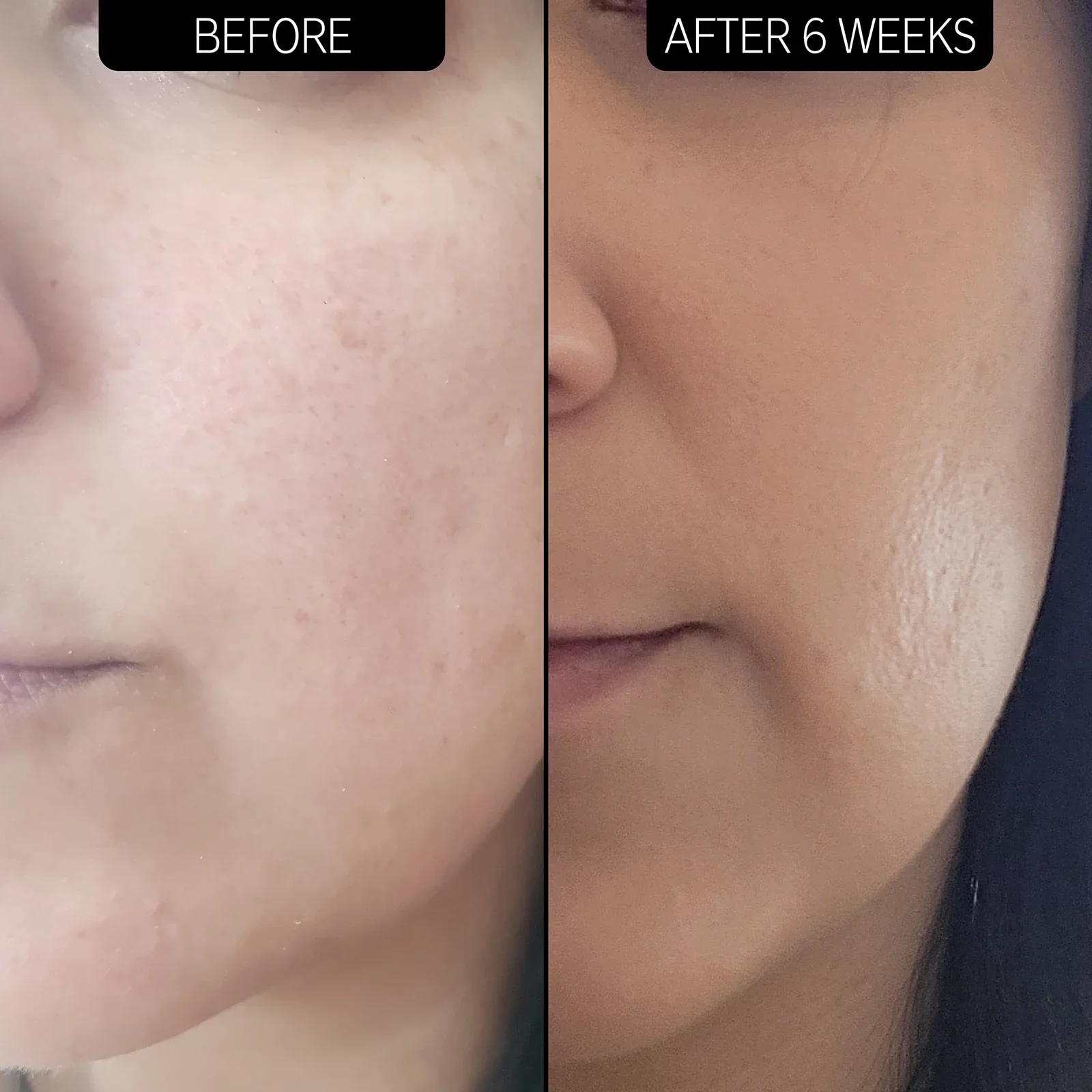 Urea Moisturizer 10% - Image 5